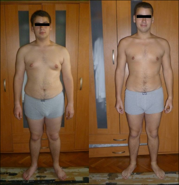 Hogyan lehet fogyni, mint ez a srác, aki 38 kg-ot fogyott a ketogén diéta és ez a diéta után;